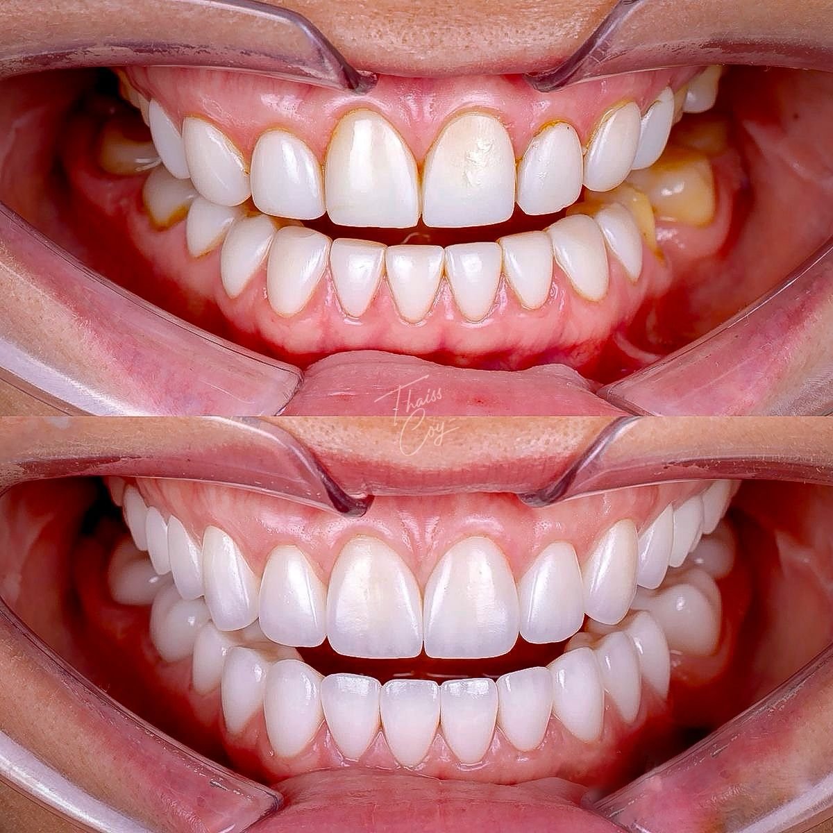 thais vieira machado